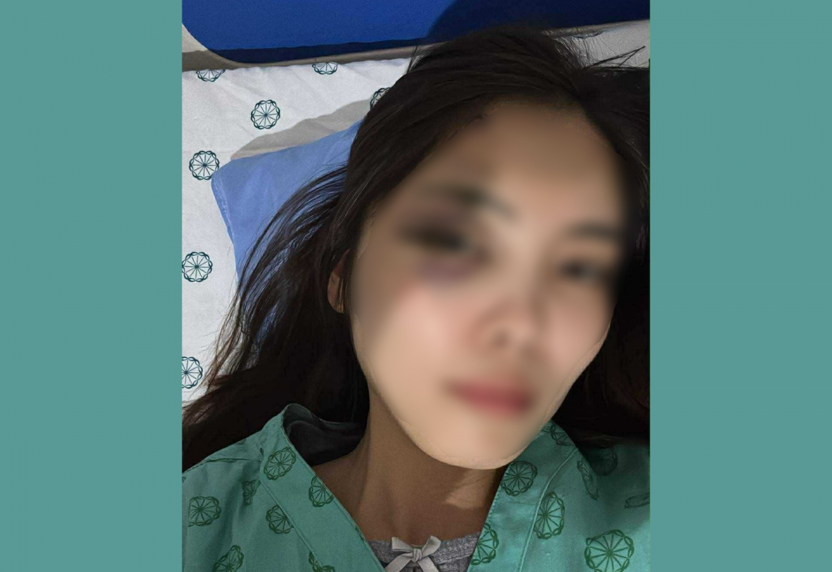 Nóng 24h: Người phụ nữ bị chồng hành hung dã man, nhập viện chấn động não